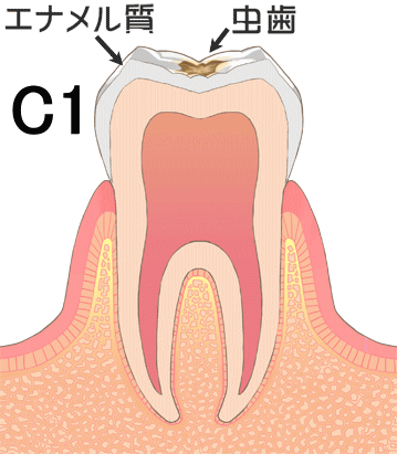 C1