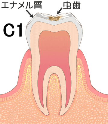 C１