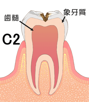 C2