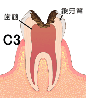 C3