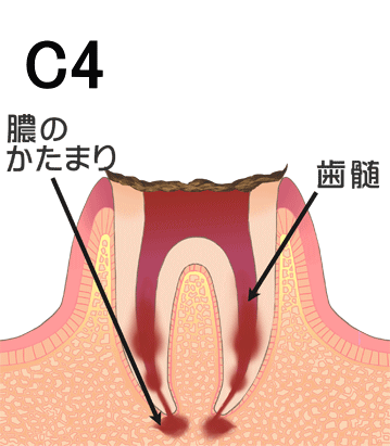 C4