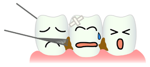 糸ようじ(フロス)の使い方