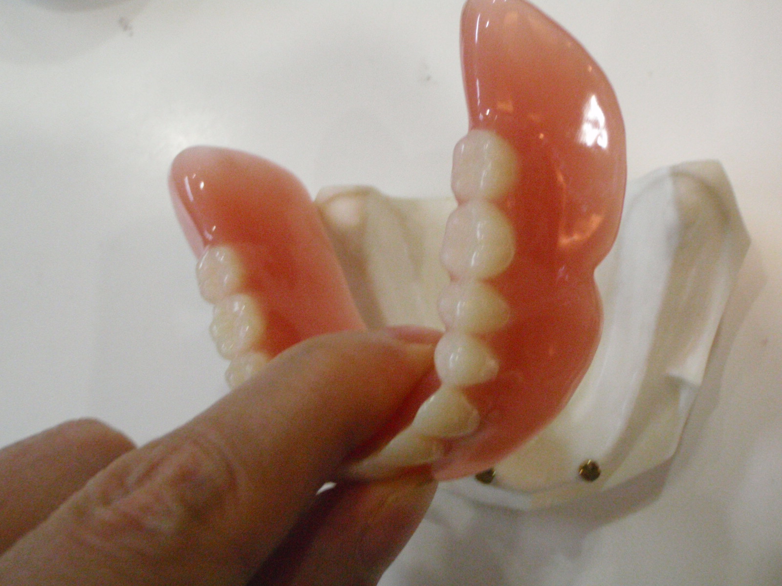 ちゅら歯科のマグネット義歯